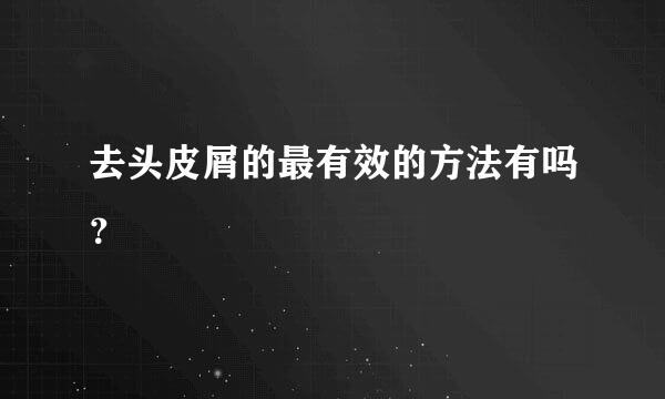 去头皮屑的最有效的方法有吗？