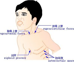 “三来自凹征”是什么意思？