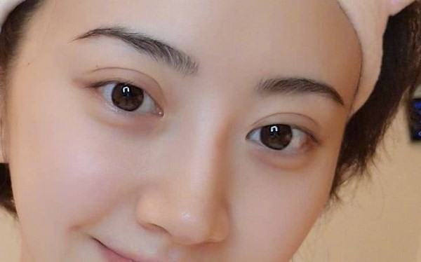 单眼皮怎样变双眼皮？