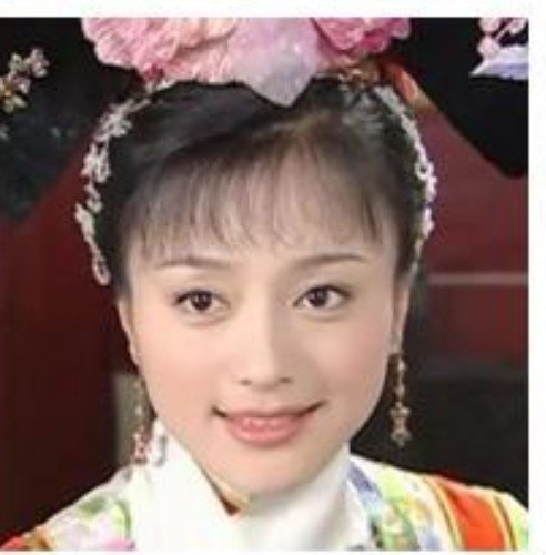 秦岚整容了吗？