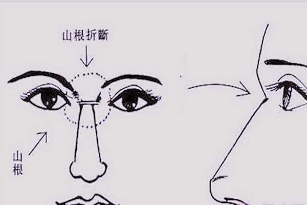 鼻子山根是哪个位置