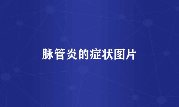 脉管炎的症状图片