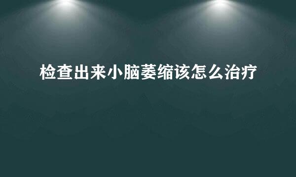 检查出来小脑萎缩该怎么治疗