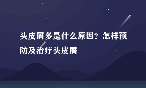头皮屑多是什么原因？怎样预防及治疗头皮屑
