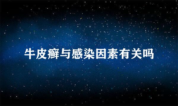 牛皮癣与感染因素有关吗