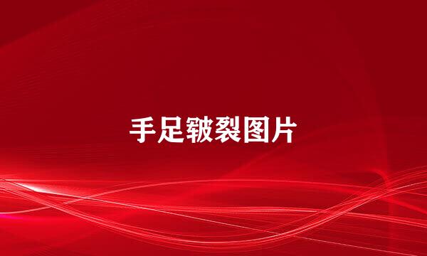 手足皲裂图片